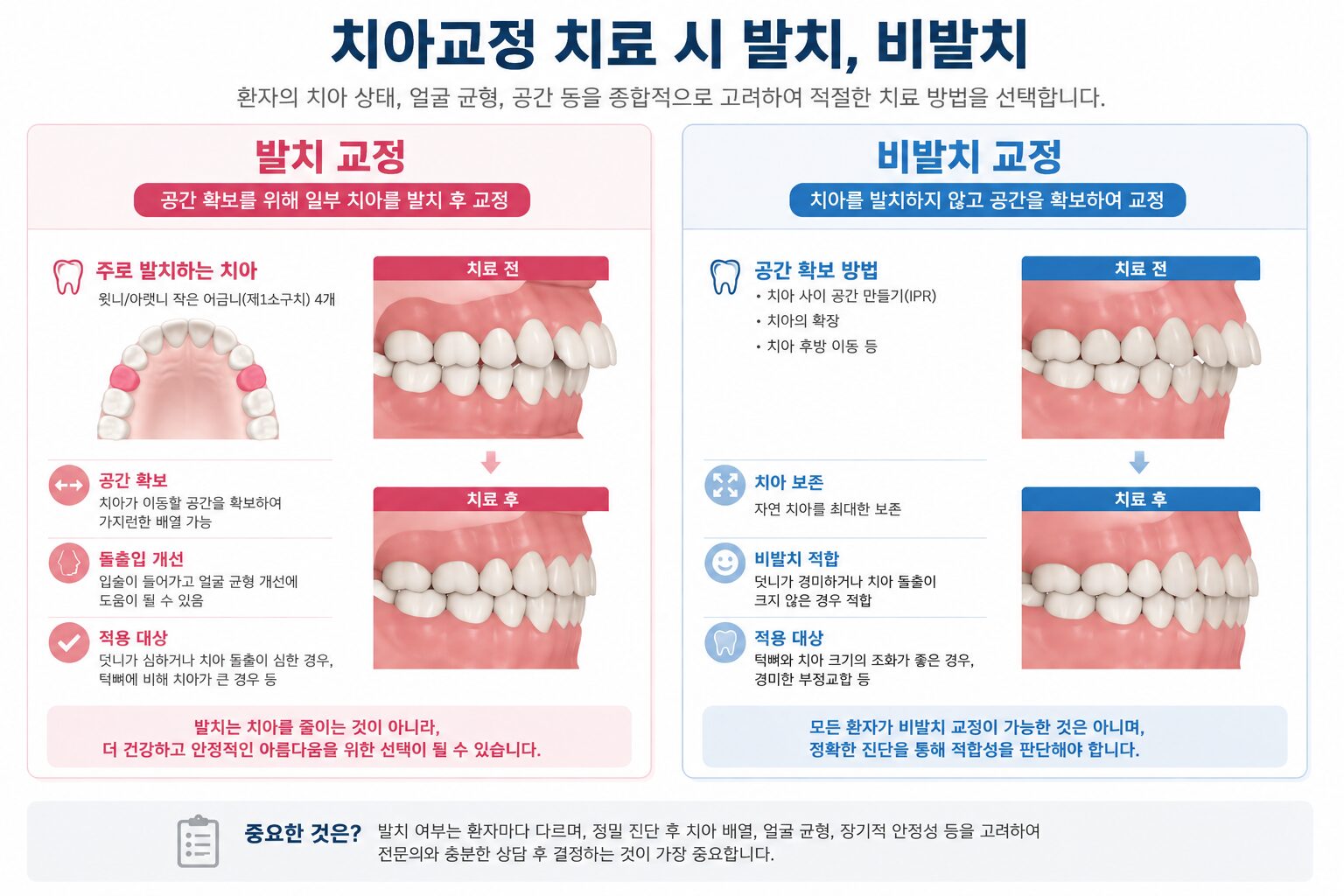 안양 교정 발치 비발치 차이 비교 스마일민 치과교정과