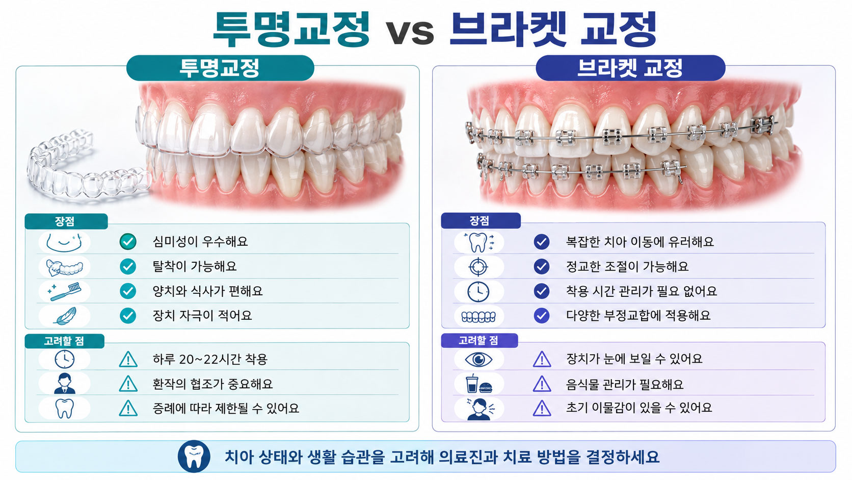 안양 투명교정 브라켓 교정 비교 스마일민 치과교정과