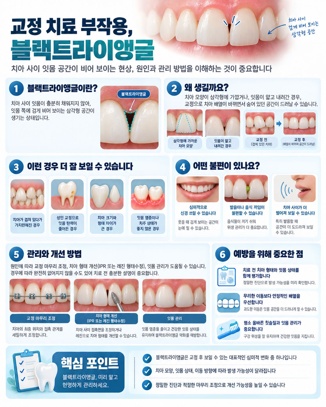 안양 교정 블랙트라이앵글 치아 사이 틈 스마일민 치과교정과